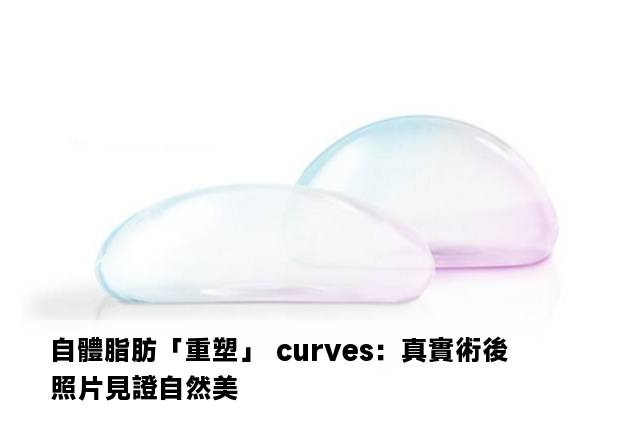 自體脂肪「重塑」 curves：真實術後照片見證自然美